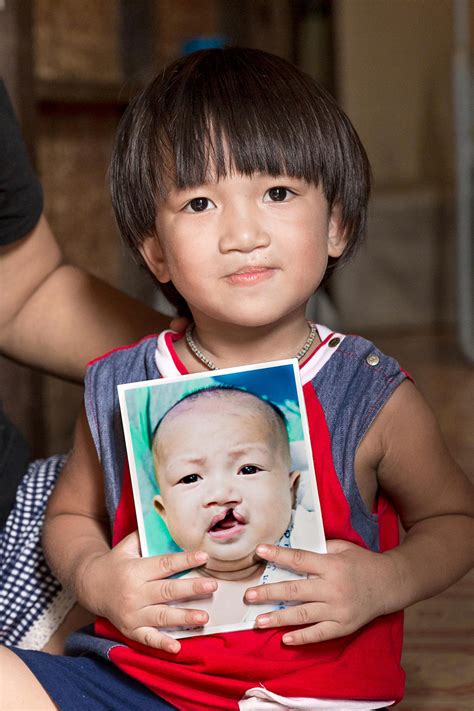 operation smile scandal|operation smile uk donations.